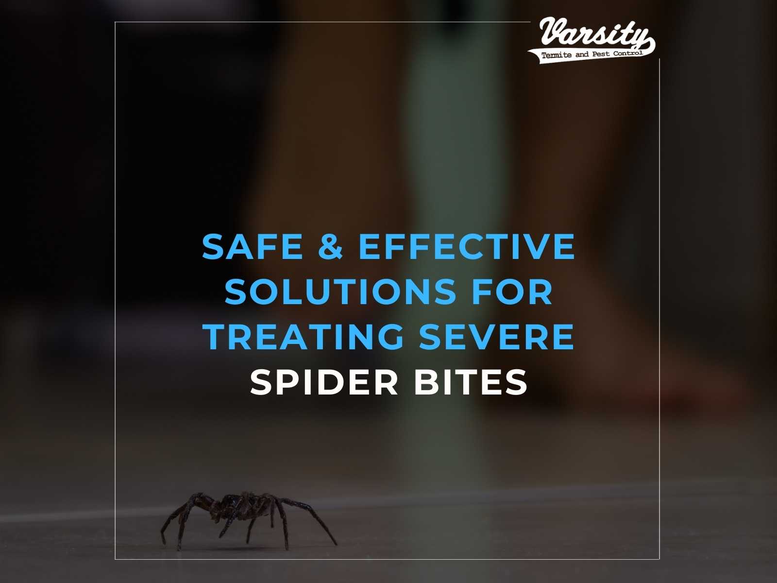 Spider Bite? Here's How To Treat It